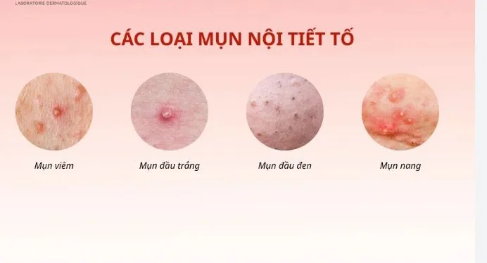 cach-tri-mun-noi-tiet-o-cam-dut-diem-tai-nha-a